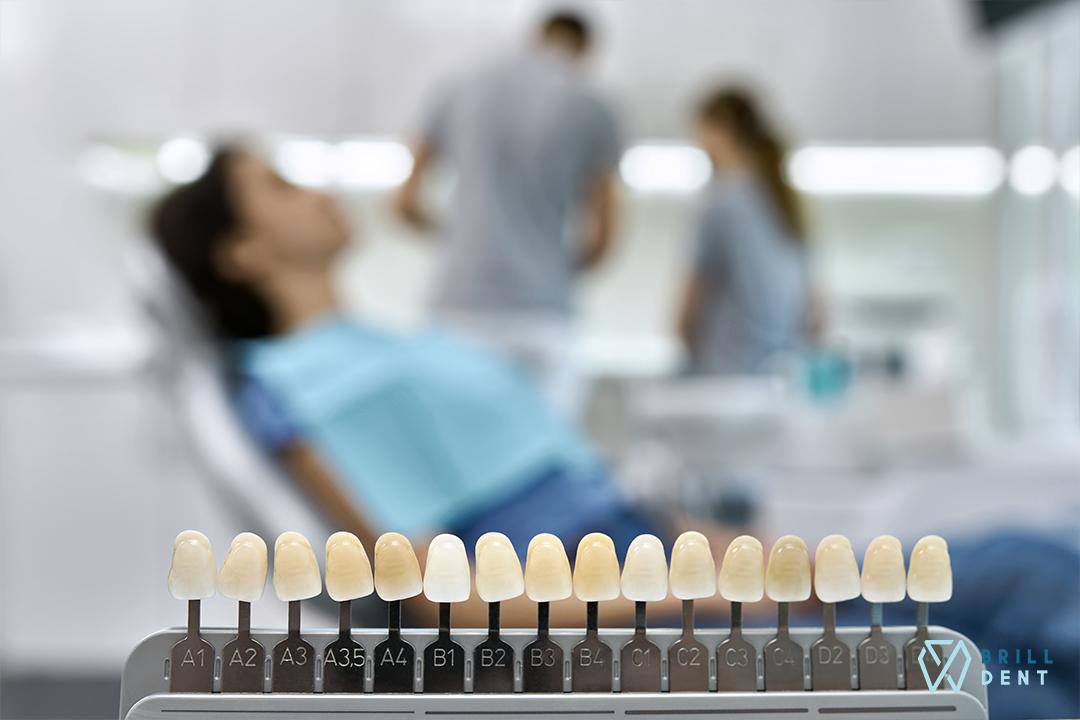 obr: 10 najčastejších otázok o bielení zubov Pure Whitening